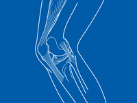 Image for knee surgery: sketch of a knee with muscles on a blue background.