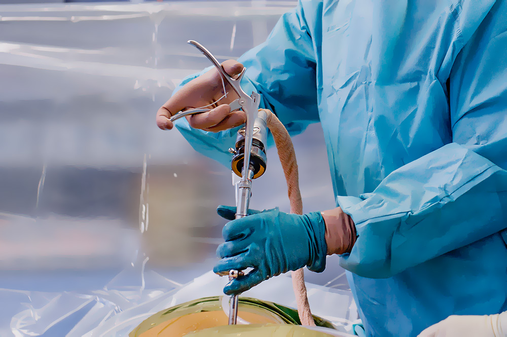 Endoskopische Wirbelsäulenchirurgie: Weniger Schmerzen, schneller fit